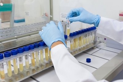 Clínica de Exame de Urina Antidrogas em Sp Parque São Lucas - Clínica de Exame de Urina para Detecção de Drogas