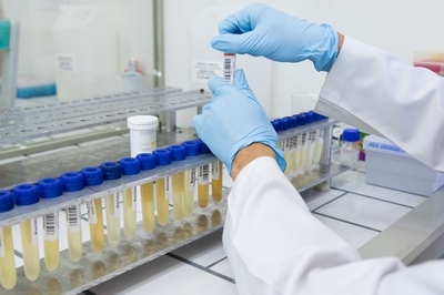 Clínica de Exame de Urina para Detecção de Drogas em Sp Santa Isabel - Clínica de Exames de Detecção de Drogas para Funcionários