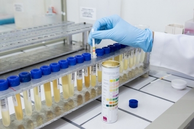 Clínica de Exame de Urina para Detectar álcool Valores Socorro - Clínica de Exame de Detecção de álcool