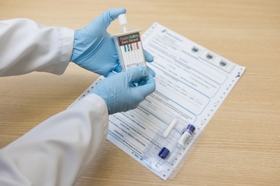 Exame para Detectar Drogas no Organismo em Sp Água Branca - Exame para Detectar Drogas no Organismo