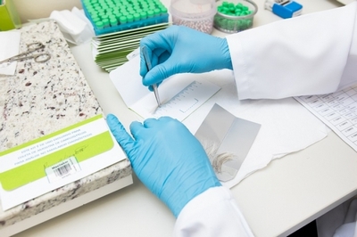 Exames para Detecção de Drogas Taboão da Serra - Teste de Detecção de Drogas