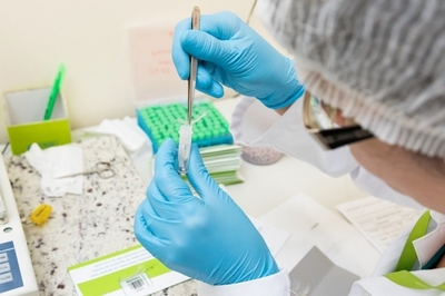 Laboratório para Exame de Detecção de Droga no Organismo em Sp Carapicuíba - Laboratório para Exame Toxicológico
