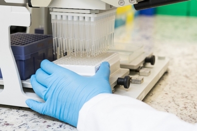 Laboratório para Exame de Detecção de Drogas Arujá - Laboratório em Exame Toxicológico