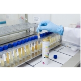análise toxicológico urina