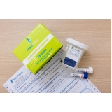 clínica de coleta de urina para exame toxicológico barata Jabaquara